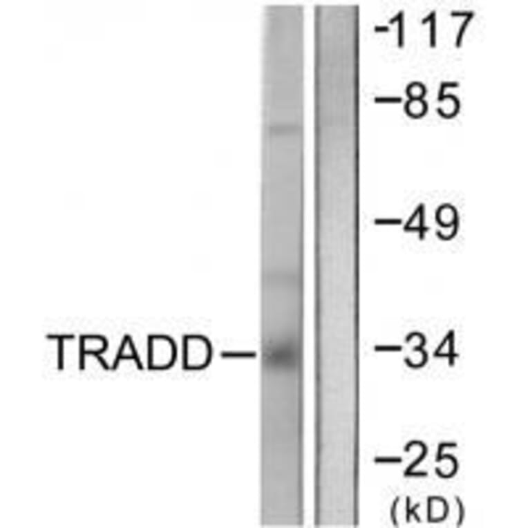 Western blot - TRADD Antibody from Signalway Antibody (33529) - Antibodies.com