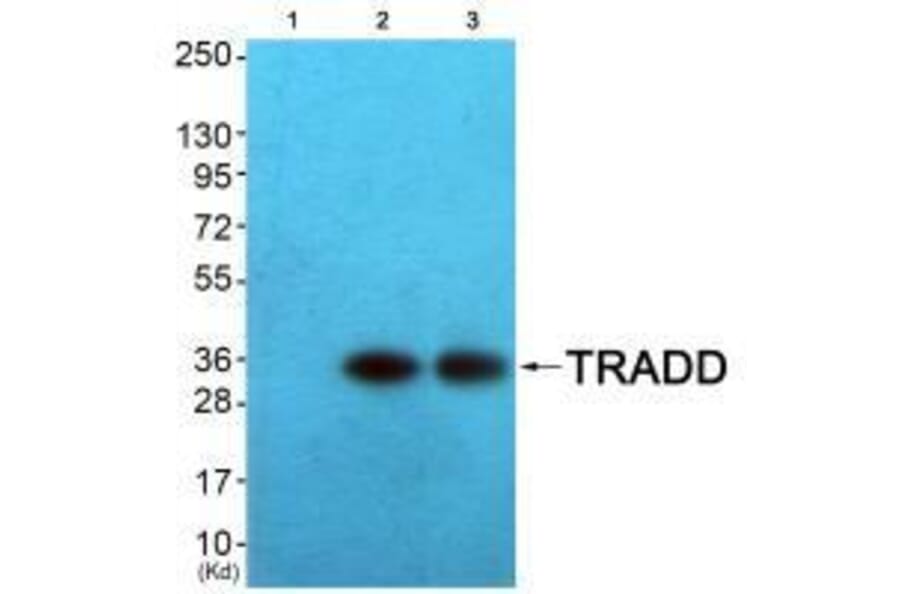 Western blot - TRADD Antibody from Signalway Antibody (33529) - Antibodies.com
