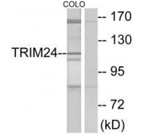 Western blot - TRIM24 Antibody from Signalway Antibody (33576) - Antibodies.com