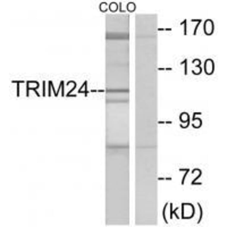 Western blot - TRIM24 Antibody from Signalway Antibody (33576) - Antibodies.com