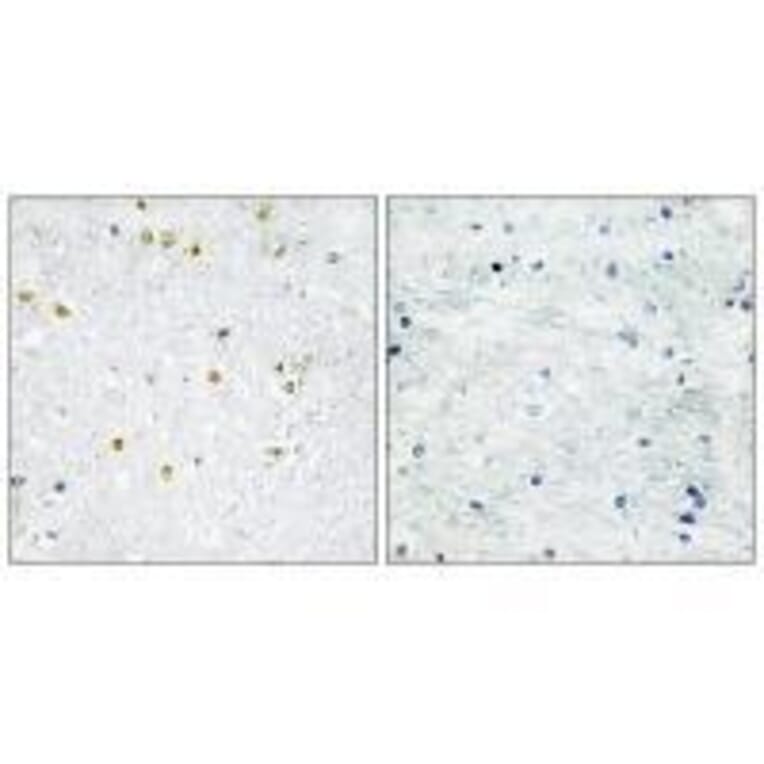 Immunohistochemistry - TRIM24 Antibody from Signalway Antibody (33576) - Antibodies.com