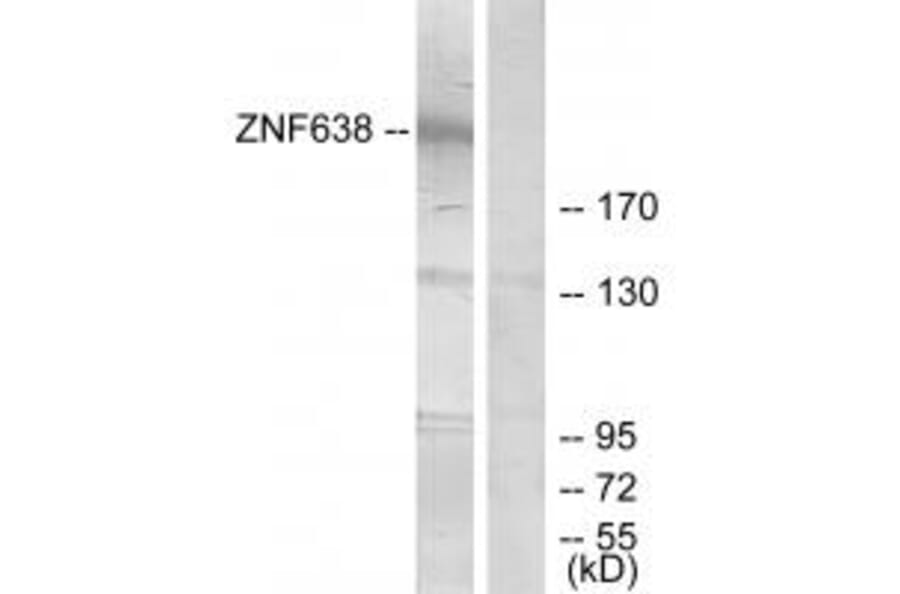 Western blot - ZNF638 Antibody from Signalway Antibody (33886) - Antibodies.com