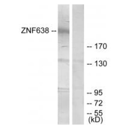 Western blot - ZNF638 Antibody from Signalway Antibody (33886) - Antibodies.com