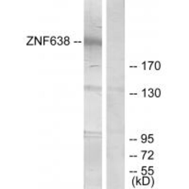 Western blot - ZNF638 Antibody from Signalway Antibody (33886) - Antibodies.com
