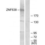 Western blot - ZNF638 Antibody from Signalway Antibody (33886) - Antibodies.com