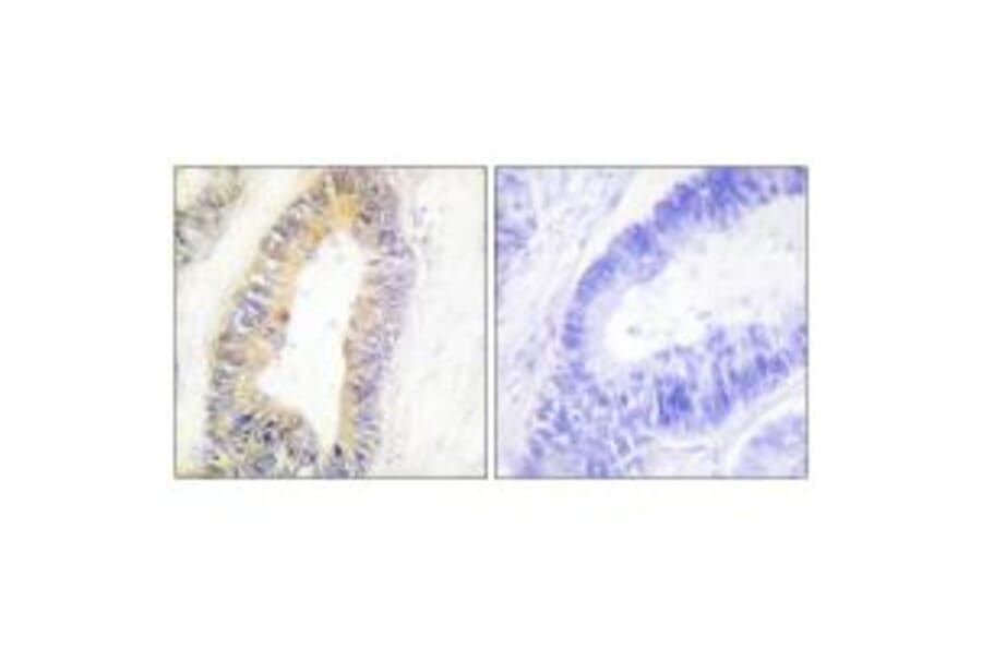 Immunohistochemistry - ZNF638 Antibody from Signalway Antibody (33886) - Antibodies.com