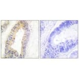 Immunohistochemistry - ZNF638 Antibody from Signalway Antibody (33886) - Antibodies.com