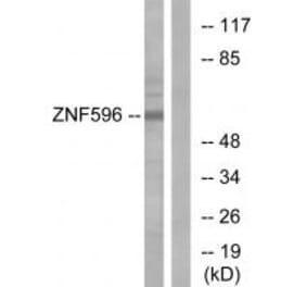 Western blot - ZNF596 Antibody from Signalway Antibody (33986) - Antibodies.com