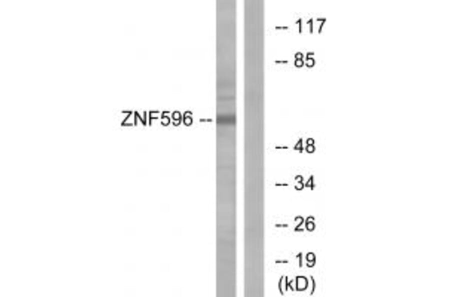 Western blot - ZNF596 Antibody from Signalway Antibody (33986) - Antibodies.com