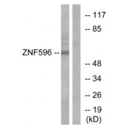 Western blot - ZNF596 Antibody from Signalway Antibody (33986) - Antibodies.com