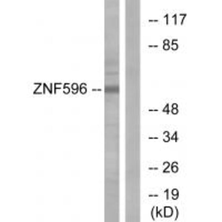 Western blot - ZNF596 Antibody from Signalway Antibody (33986) - Antibodies.com