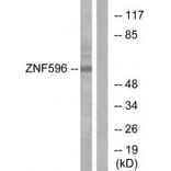 Western blot - ZNF596 Antibody from Signalway Antibody (33986) - Antibodies.com