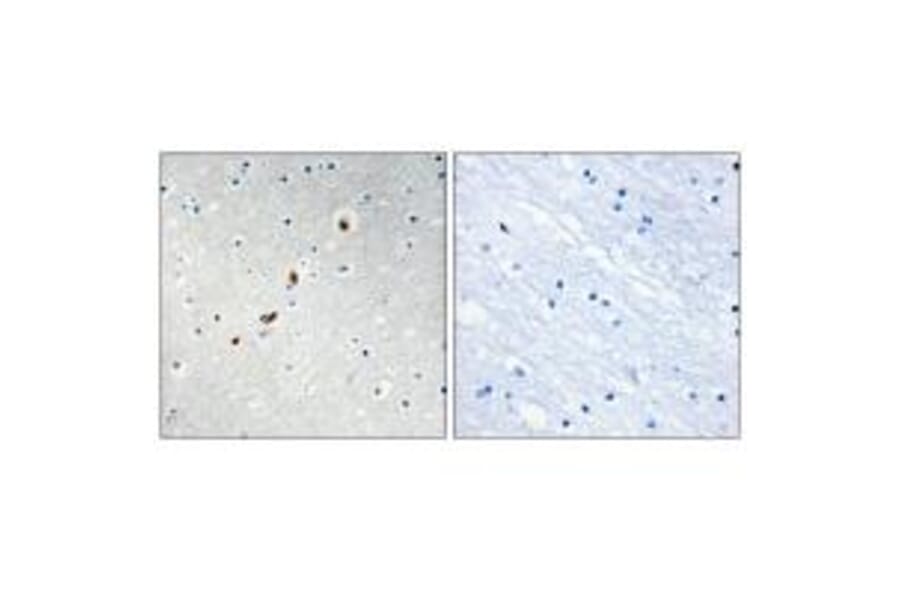 Immunohistochemistry - ZNF596 Antibody from Signalway Antibody (33986) - Antibodies.com