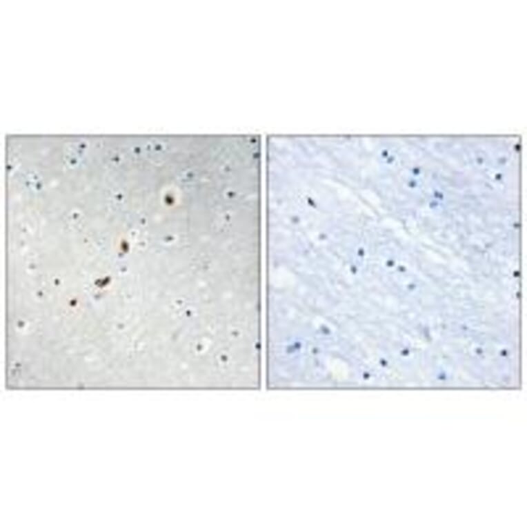 Immunohistochemistry - ZNF596 Antibody from Signalway Antibody (33986) - Antibodies.com