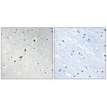 Immunohistochemistry - ZNF596 Antibody from Signalway Antibody (33986) - Antibodies.com