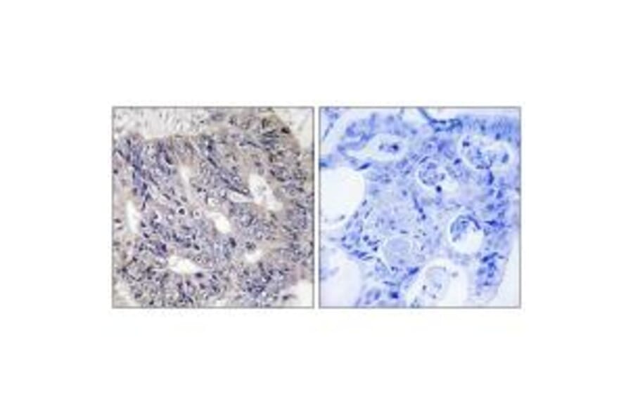 Immunohistochemistry - ES8L1 Antibody from Signalway Antibody (33991) - Antibodies.com