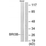 Western blot - BRI3B Antibody from Signalway Antibody (34000) - Antibodies.com