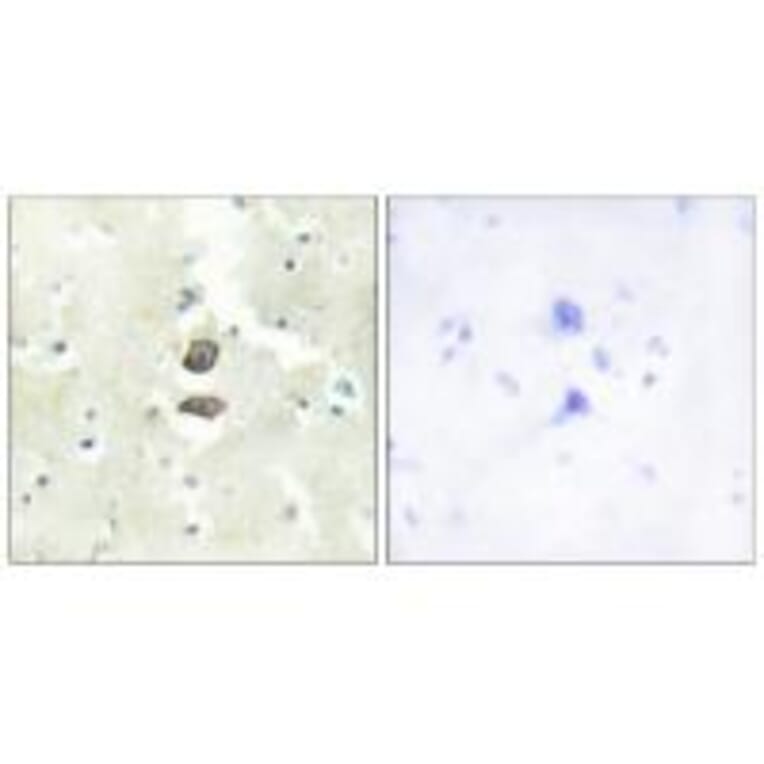 Immunohistochemistry - BRI3B Antibody from Signalway Antibody (34000) - Antibodies.com