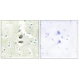 Immunohistochemistry - BRI3B Antibody from Signalway Antibody (34000) - Antibodies.com