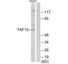 Western blot - TAF15 Antibody from Signalway Antibody (34006) - Antibodies.com
