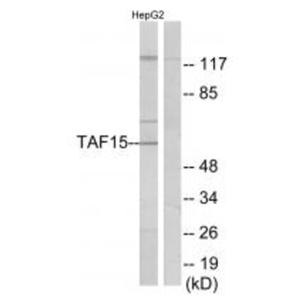 Western blot - TAF15 Antibody from Signalway Antibody (34006) - Antibodies.com
