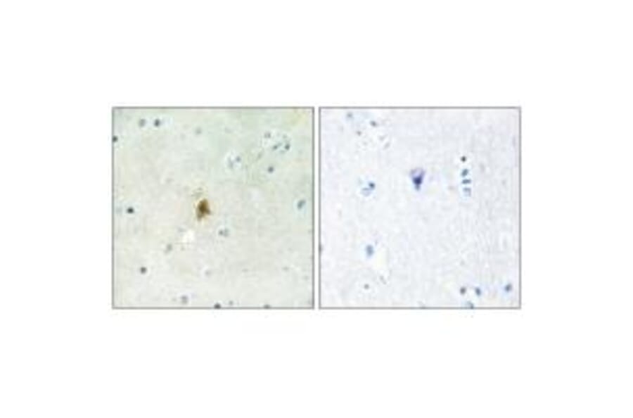 Immunohistochemistry - TAF15 Antibody from Signalway Antibody (34006) - Antibodies.com