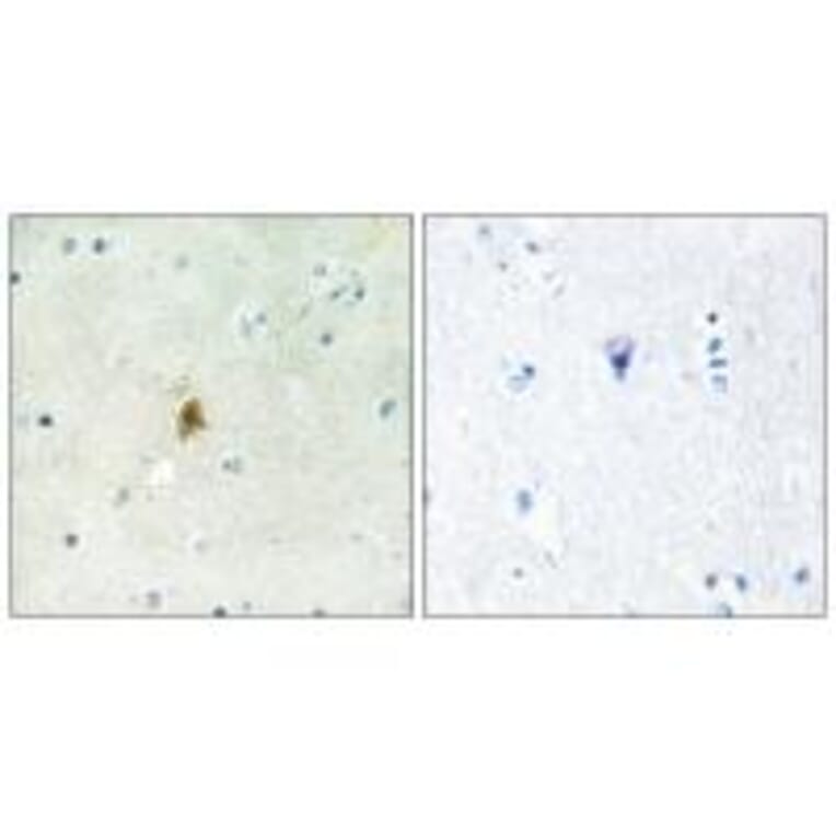 Immunohistochemistry - TAF15 Antibody from Signalway Antibody (34006) - Antibodies.com