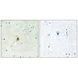 Immunohistochemistry - TAF15 Antibody from Signalway Antibody (34006) - Antibodies.com