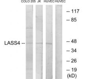 Western blot - LASS4 Antibody from Signalway Antibody (34069) - Antibodies.com