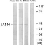 Western blot - LASS4 Antibody from Signalway Antibody (34069) - Antibodies.com