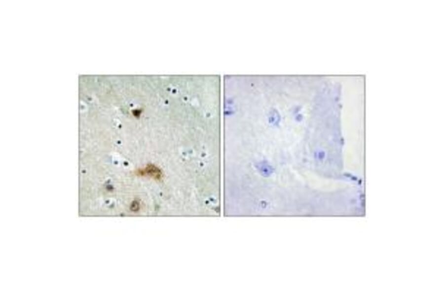 Immunohistochemistry - LASS4 Antibody from Signalway Antibody (34069) - Antibodies.com