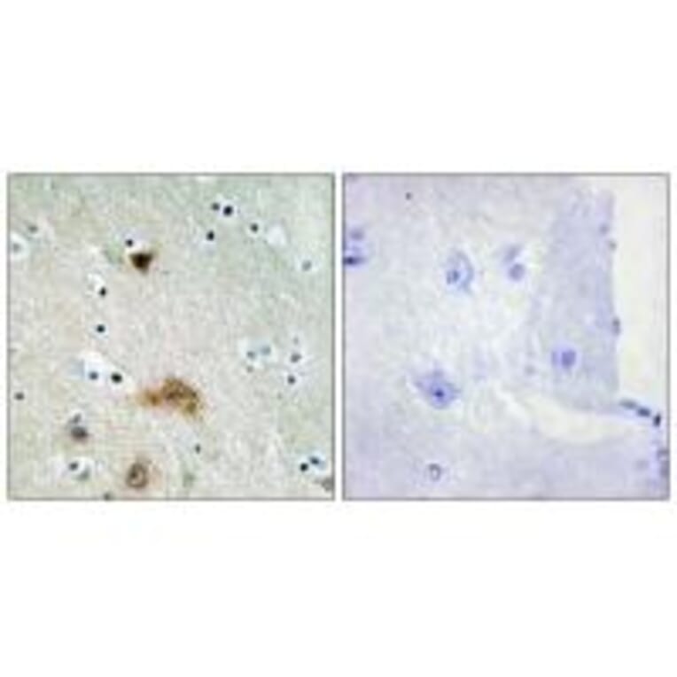 Immunohistochemistry - LASS4 Antibody from Signalway Antibody (34069) - Antibodies.com