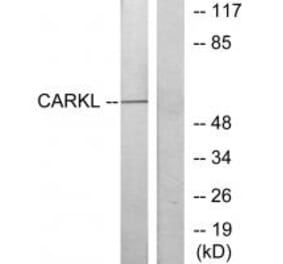 Western blot - CARKL Antibody from Signalway Antibody (34105) - Antibodies.com