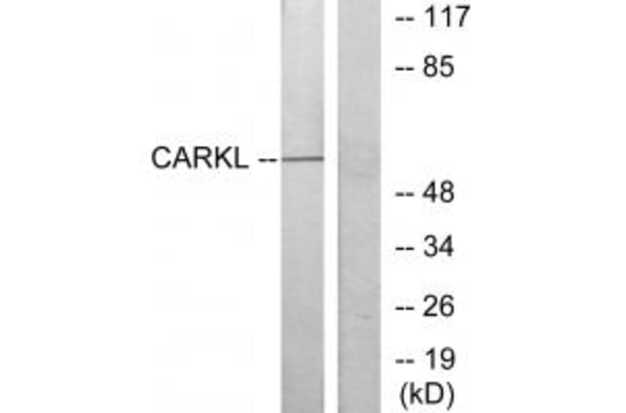 Western blot - CARKL Antibody from Signalway Antibody (34105) - Antibodies.com