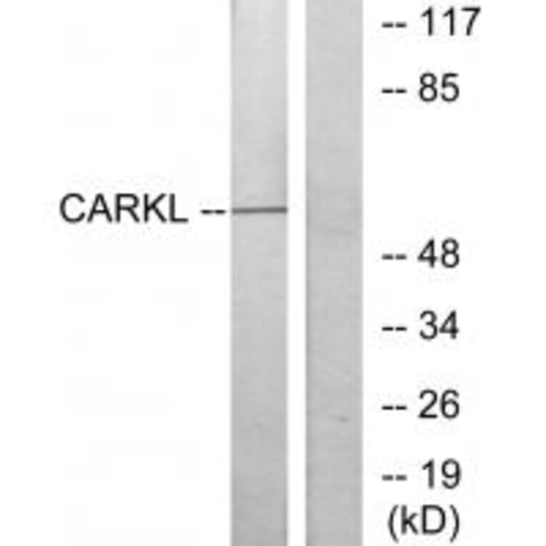 Western blot - CARKL Antibody from Signalway Antibody (34105) - Antibodies.com
