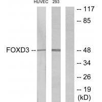 Western blot analysis of extracts from HUVEC cells and 293 cells, using FOXD3 antibody #34110.