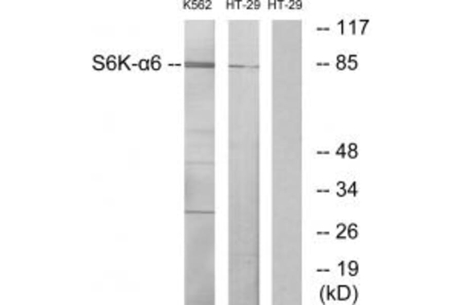 Western blot - S6K-α6 Antibody from Signalway Antibody (34111) - Antibodies.com