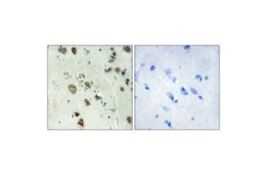 Immunohistochemistry - S6K-α6 Antibody from Signalway Antibody (34111) - Antibodies.com