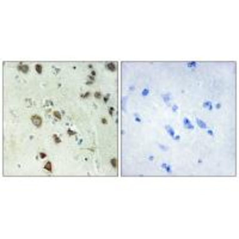 Immunohistochemistry - S6K-α6 Antibody from Signalway Antibody (34111) - Antibodies.com