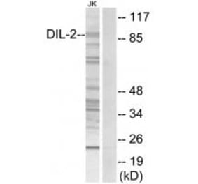 Western blot - DIL-2 Antibody from Signalway Antibody (34117) - Antibodies.com