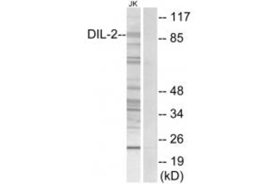 Western blot - DIL-2 Antibody from Signalway Antibody (34117) - Antibodies.com
