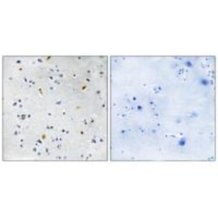 Immunohistochemistry - DIL-2 Antibody from Signalway Antibody (34117) - Antibodies.com