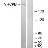 Western blot - MRCKB Antibody from Signalway Antibody (34138) - Antibodies.com