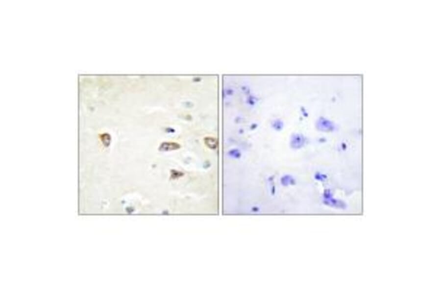 Immunohistochemistry - MRCKB Antibody from Signalway Antibody (34138) - Antibodies.com
