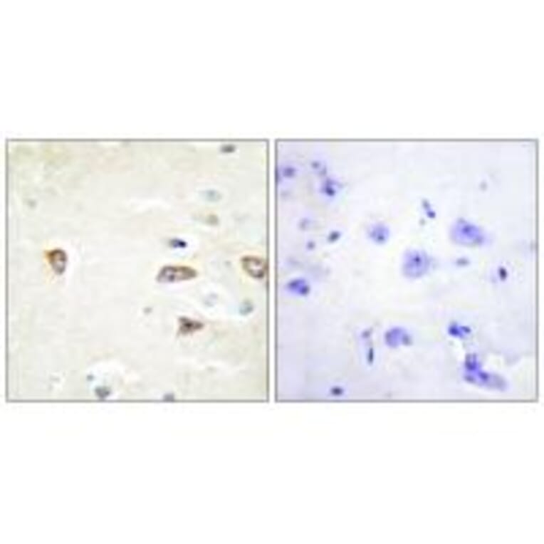 Immunohistochemistry - MRCKB Antibody from Signalway Antibody (34138) - Antibodies.com