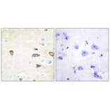 Immunohistochemistry - MRCKB Antibody from Signalway Antibody (34138) - Antibodies.com
