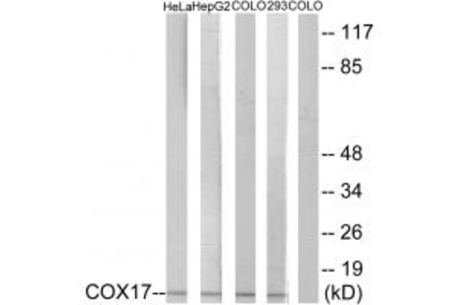 Western blot - COX17 Antibody from Signalway Antibody (34220) - Antibodies.com