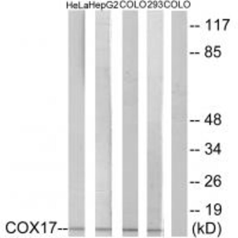Western blot - COX17 Antibody from Signalway Antibody (34220) - Antibodies.com