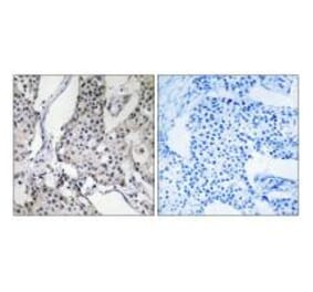 Immunohistochemistry - PHLDA3 Antibody from Signalway Antibody (34295) - Antibodies.com