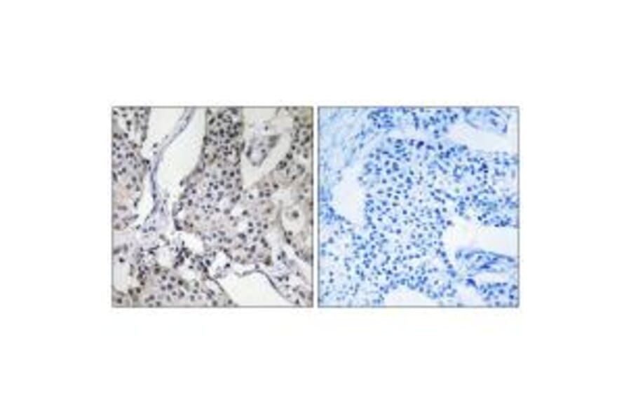 Immunohistochemistry - PHLDA3 Antibody from Signalway Antibody (34295) - Antibodies.com